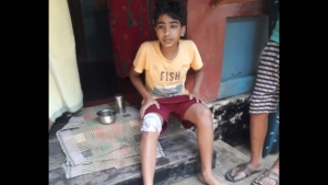 
                        കൂനംവെള്ളിക്കാവിൽ കാട്ടുപന്നി ആക്രമണം: ഒരു കുട്ടിക്ക് പരിക്ക്