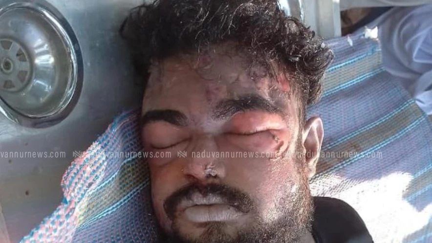 നരിക്കുനി പന്നിക്കോട്ടൂരിൽ സ്വകാര്യ വ്യക്തിയുടെ കിണറിൽ അജ്ഞാതന്റെ മൃതദേഹം