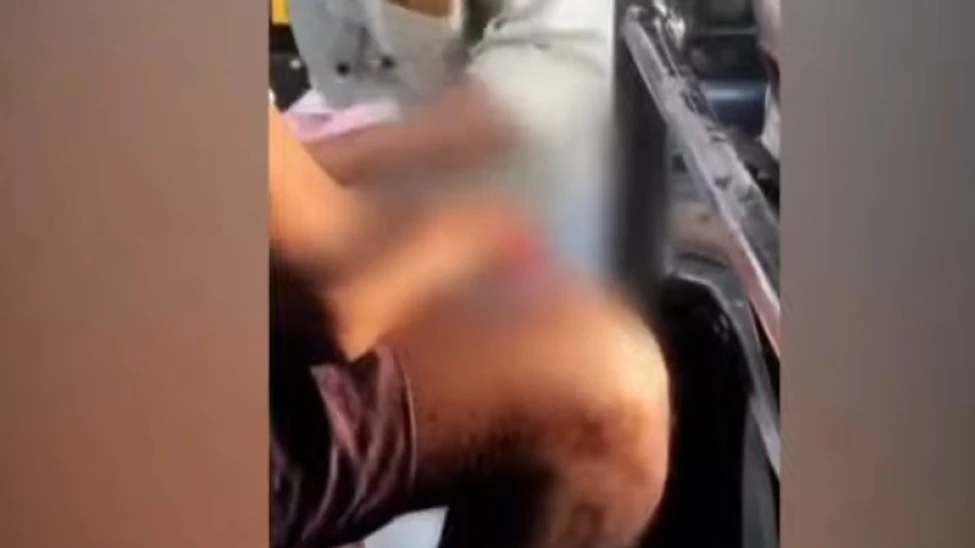 മണ്ണാർക്കാട് കുട്ടികളെയും അധ്യാപകനെയുമടക്കം നിരവധി പേരെ പേപ്പട്ടി ആക്രമിച്ചു