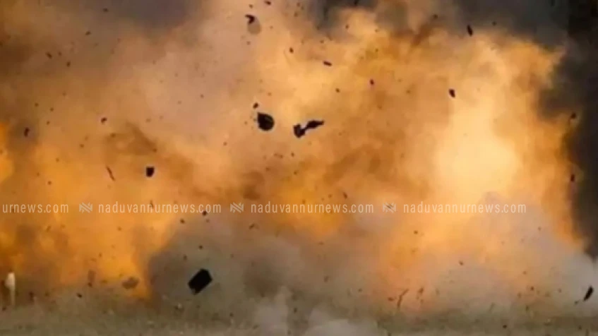 ബോംബ് നിര്‍മാണത്തിനിടെ ഉണ്ടായ പൊട്ടിത്തെറിയില്‍ 17കാരന്റെ ഇരുകൈപ്പത്തികളും നഷ്ടപ്പെട്ടു