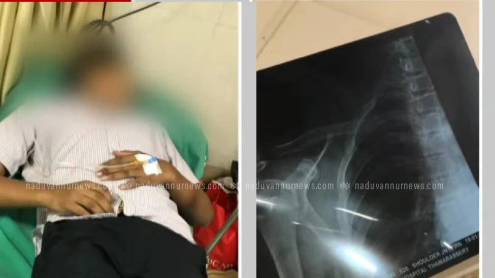 താമരശ്ശേരി ജിവിഎച്ച്എസ്എസ് വിദ്യാർത്ഥിയെ സീനിയർ വിദ്യാർഥികൾ റാഗ് ചെയ്തതായി പരാതി