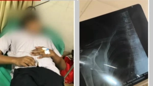 
                        താമരശ്ശേരി ജിവിഎച്ച്എസ്എസ് വിദ്യാർത്ഥിയെ സീനിയർ വിദ്യാർഥികൾ റാഗ് ചെയ്തതായി പരാതി