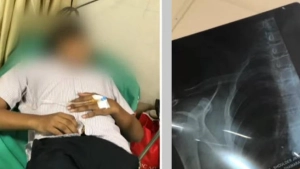 
                        താമരശ്ശേരി ജിവിഎച്ച്എസ്എസിൽ വിദ്യാർത്ഥിയെ റാഗ്  ചെയ്ത സംഭവം; 8 സീനിയർ വിദ്യാർത്ഥികൾക്കെതിരെ കേസെടുത്തു 