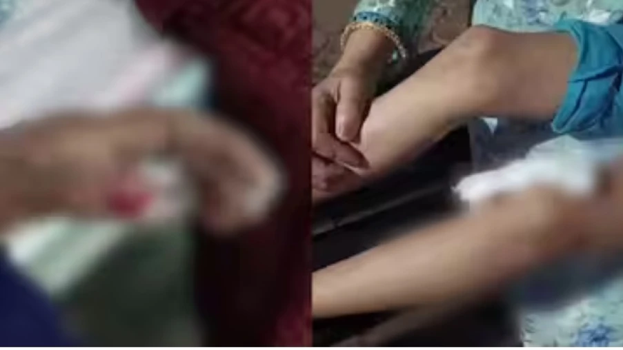 നാദാപുരത്ത് തെരുവ് നായയുടെ ആക്രമണത്തിൽ രണ്ട് പേർക്ക് പരിക്ക്