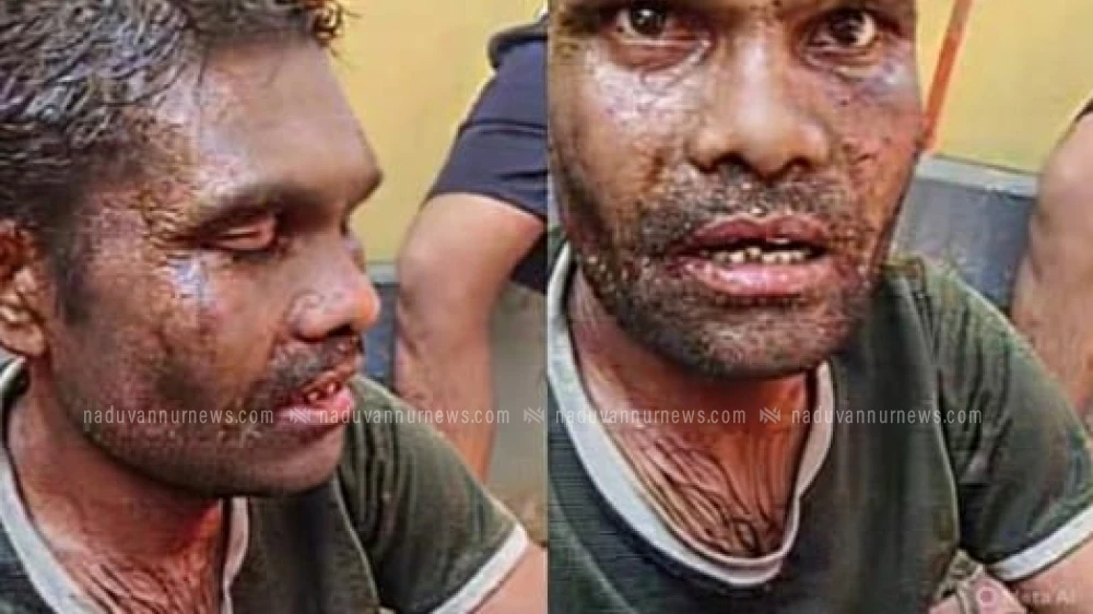  ആൾക്കൂട്ട മർദനത്തിൽ കൊല്ലപ്പെട്ട  രാം നാരായൺ നേരിട്ടത് സമാനതകളില്ലാത്ത മർദനം