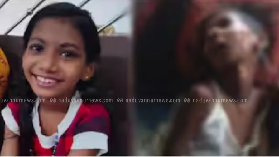 വടകരയിൽ വാഹനം ഇടിപ്പിച്ച് പരിക്കേറ്റ് കോമയിലായ കുട്ടിക്ക്, കുറ്റപത്രം