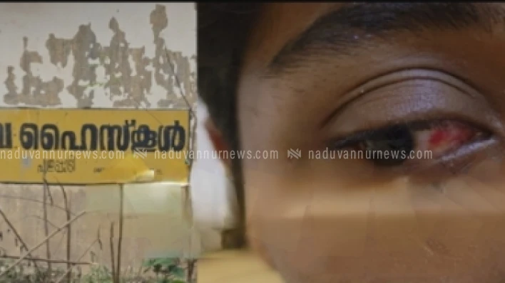 വിദ്യാർത്ഥിയെ ആക്രമിച്ച കേസിൽ നാലു വിദ്യാർത്ഥികൾക്ക് സസ്പെൻഷൻ