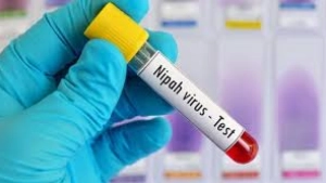 
                        സംസ്ഥാനത്ത് വീണ്ടും നിപ സ്ഥിരീകരിച്ചു