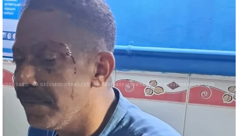  വളയത്ത് പ്രവാസിയെ വീട്ടിൽ കയറി ക്രൂരമായി അക്രമിച്ചു