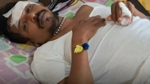 വടകരയിൽ ഭ്രാന്തൻ കുറുക്കൻ നാല് പേരെ കടിച്ചു പരിക്കേല്പിച്ചു