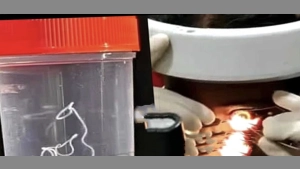 കണ്ണിൽ ചൊറിച്ചിലും അസ്വസ്ഥതയും ; യുവതി യുടെ കണ്ണിൽ നിന്നും പുറത്തെടുത്തത് 10 സെന്റിമീറ്റർ നീളമുള്ള ജീവനുള്ള വിര