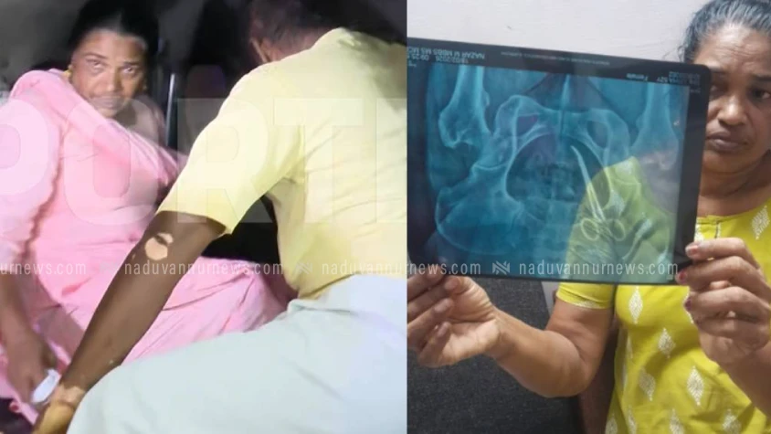  വീട്ടമ്മയുടെ വയറ്റില്‍ കത്രിക കുടുങ്ങിയ സംഭവം: ഉഷ ജോസഫിനെ ആശുപത്രിയിലേക്ക് മാറ്റി