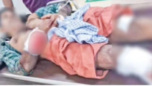 
                        ബാലുശേരിയിൽ കാട്ടു പന്നിയുടെ ആക്രമണത്തിൽ തെങ്ങുകയറ്റ തൊഴിലാളിക്ക് ഗുരുതര പരിക്ക്