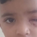 തെരുവുനായ ആക്രമണം രണ്ടര വയസ്സുകാരന് പരിക്ക്