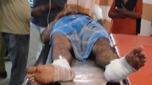 കൊയിലാണ്ടിയില്‍ ട്രെയിന്‍ തട്ടി അരിക്കുളം സ്വദേശിയായ യുവാവിന് ഗുരുതര പരിക്ക്