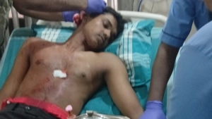 നാദാപുരത്ത് വന്യജീവി ആക്രമണത്തിൽ യുവാവിന് പരിക്ക്